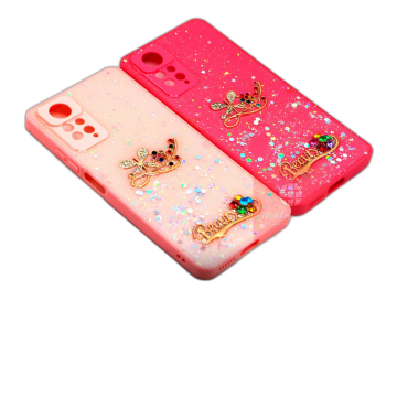 Xiaomi Redmi Note 11 Pro Shine Glitter Beauty Case - Image 2